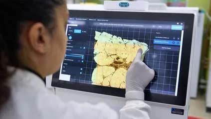 평생 쌓인 DNA 돌연변이, 자가면역 질환의 숨겨진 방아쇠였다