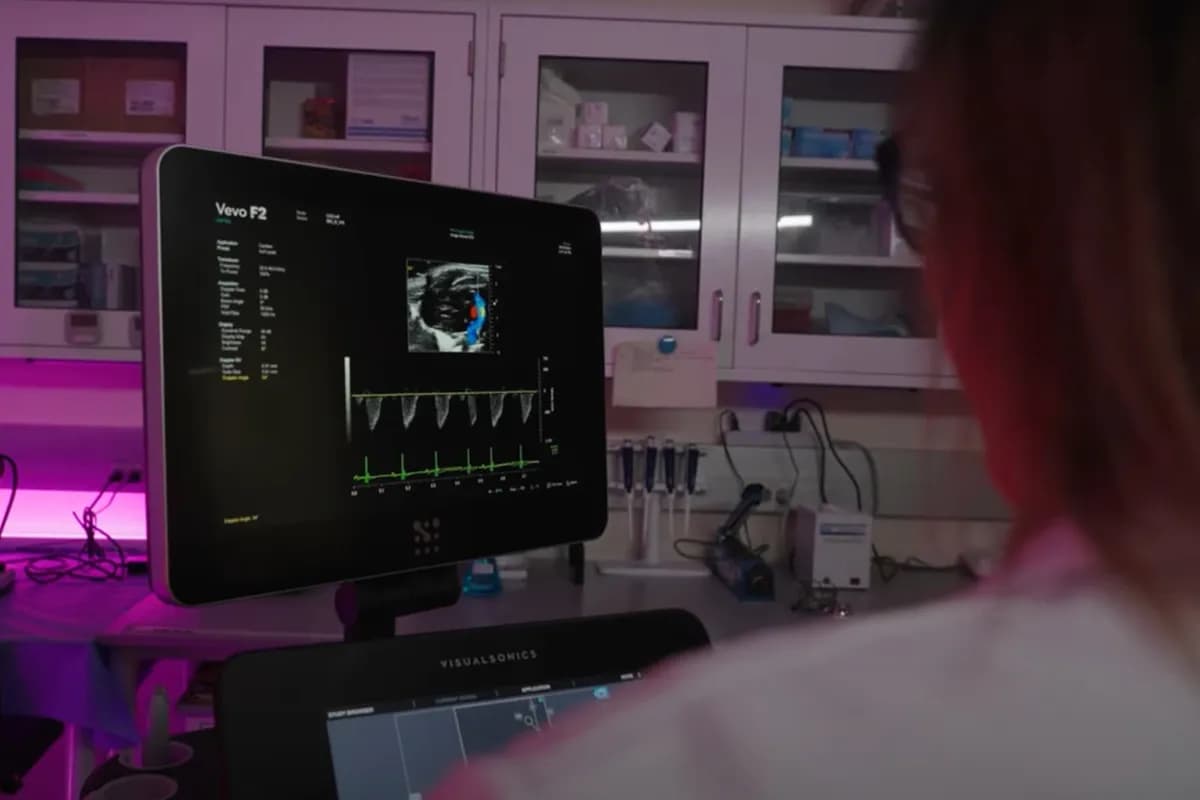 미국 연구진, 심장 소리로 심근경색 예측하는 AI 개발